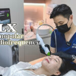 thermage flx cost