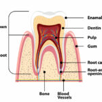 affordable root canal singapore